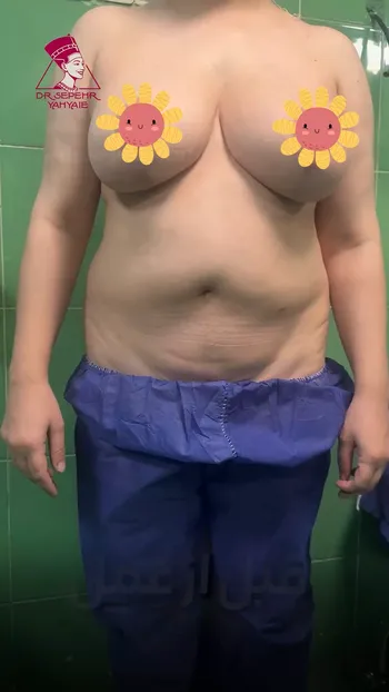 Patient Story